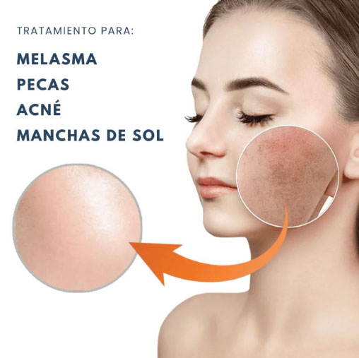 promo